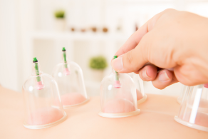 Cupping treatment