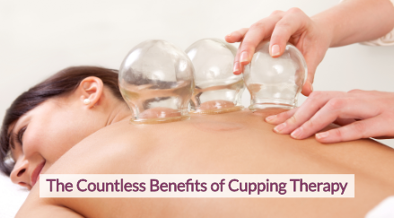 Woman getting a cupping treatment